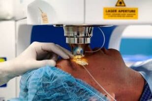 Operacja widzenia laserowego
